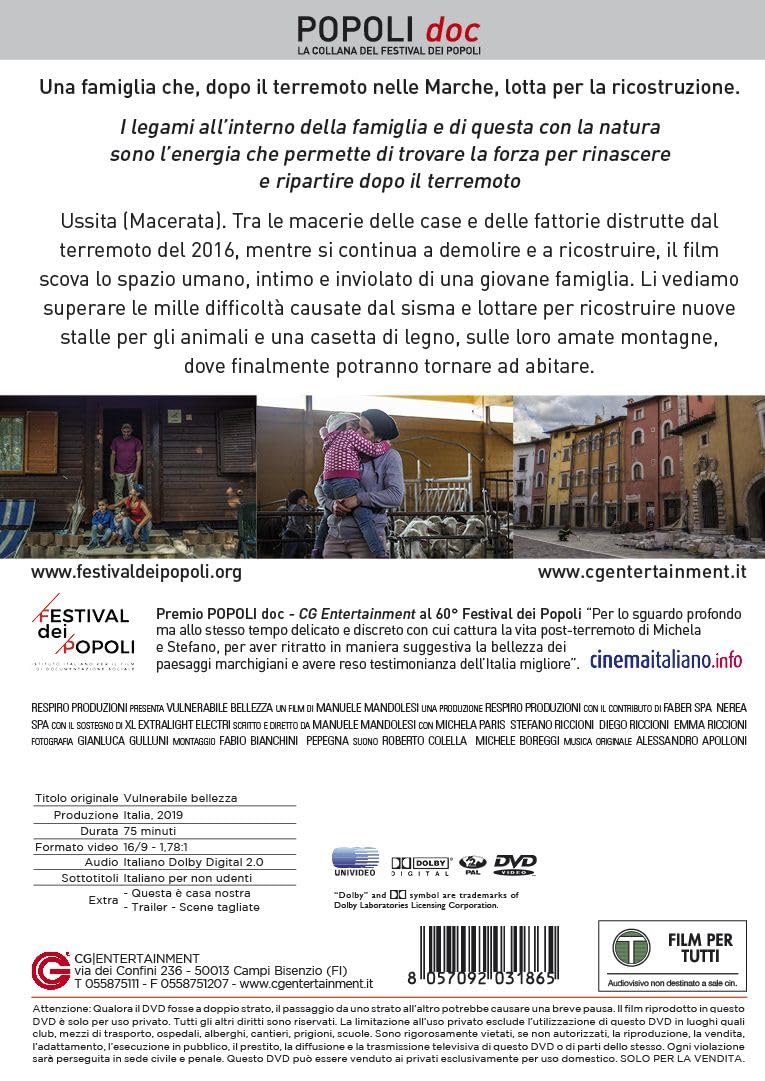 Dvd - Vulnerabile Bellezza (1 DVD