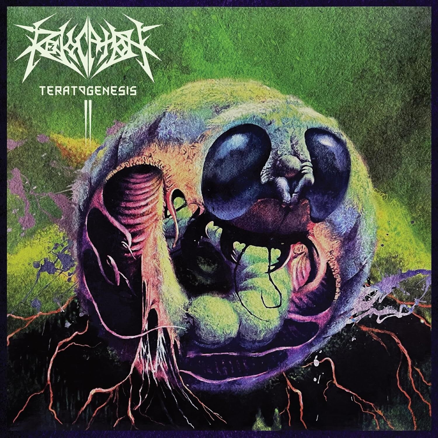 Teratogenesis
