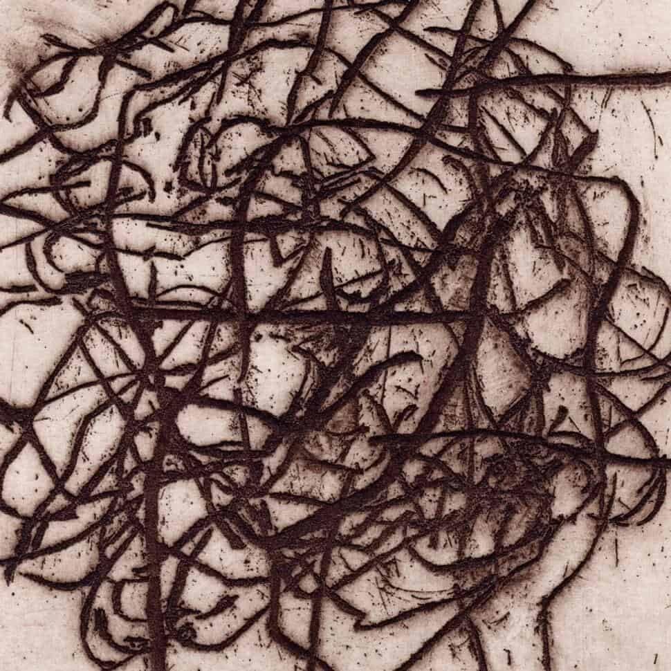 Arrhythmian