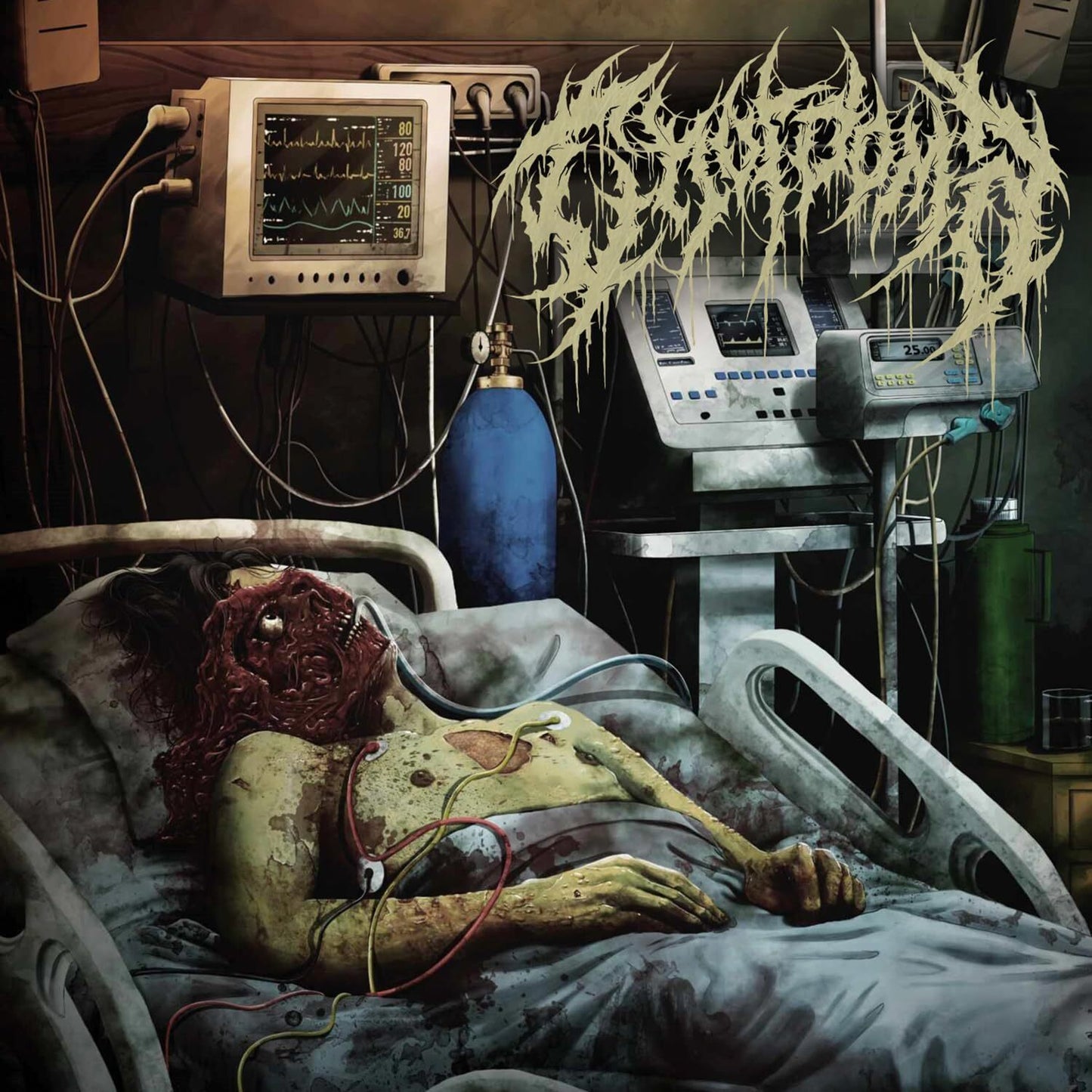 Chordoma