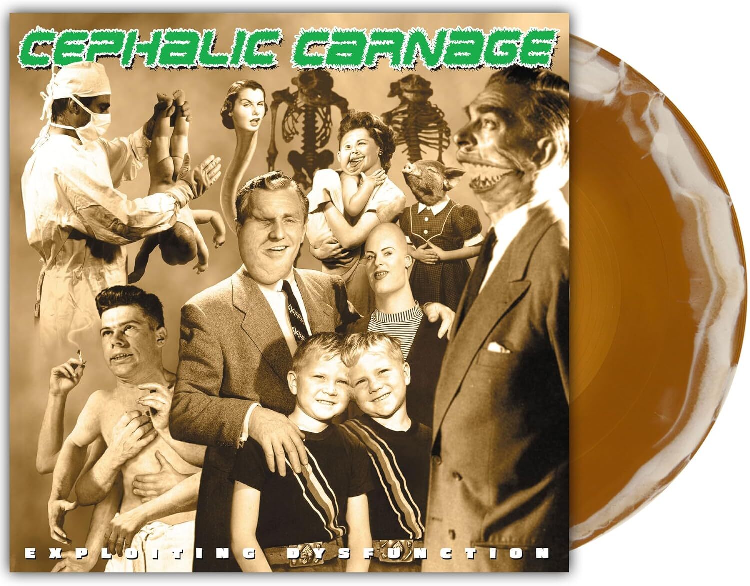 Exploiting Dysfunction (Deluxe 25th Anniversary Reissue)