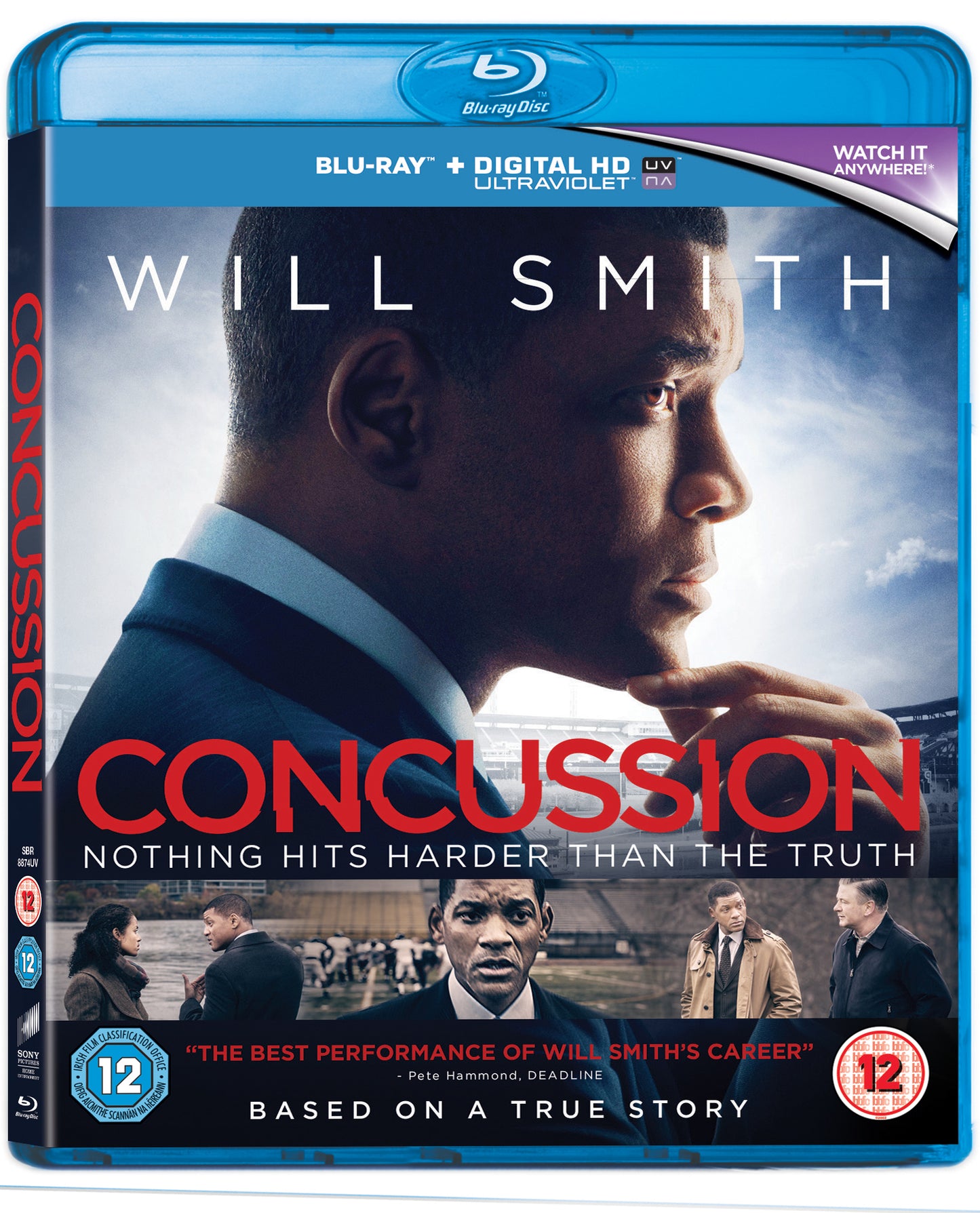 Concussion