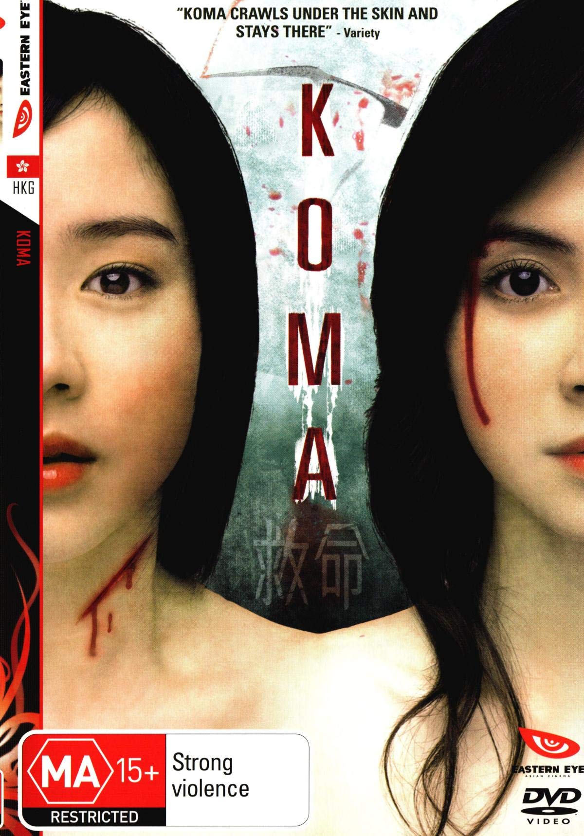Koma