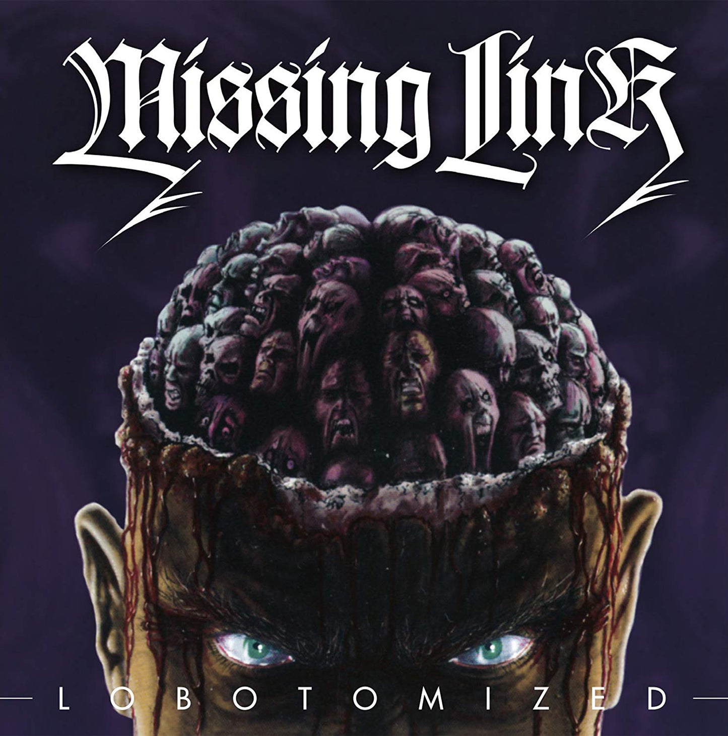 Lobotomized