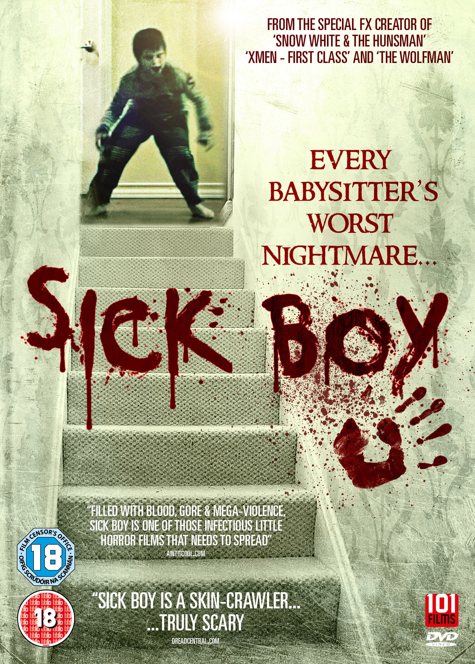 Sick Boy