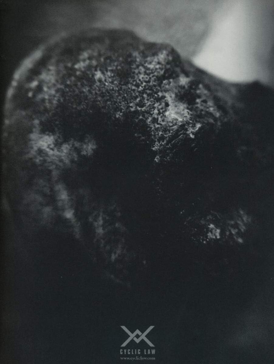 Wound Of Body