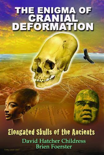 Enigma of Cranial Deformation