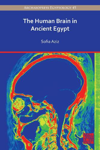 The Human Brain in Ancient Egypt