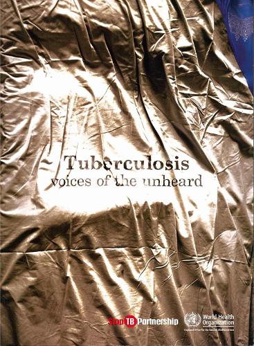 Tuberculosis