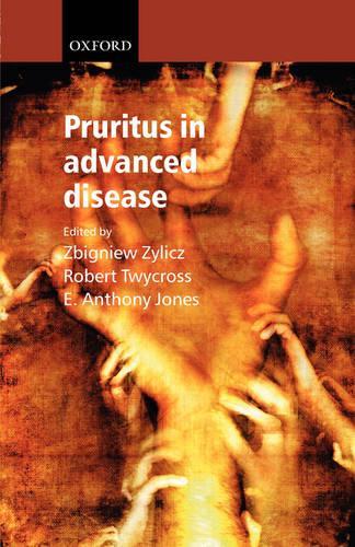 Pruritus in Advanced Disease