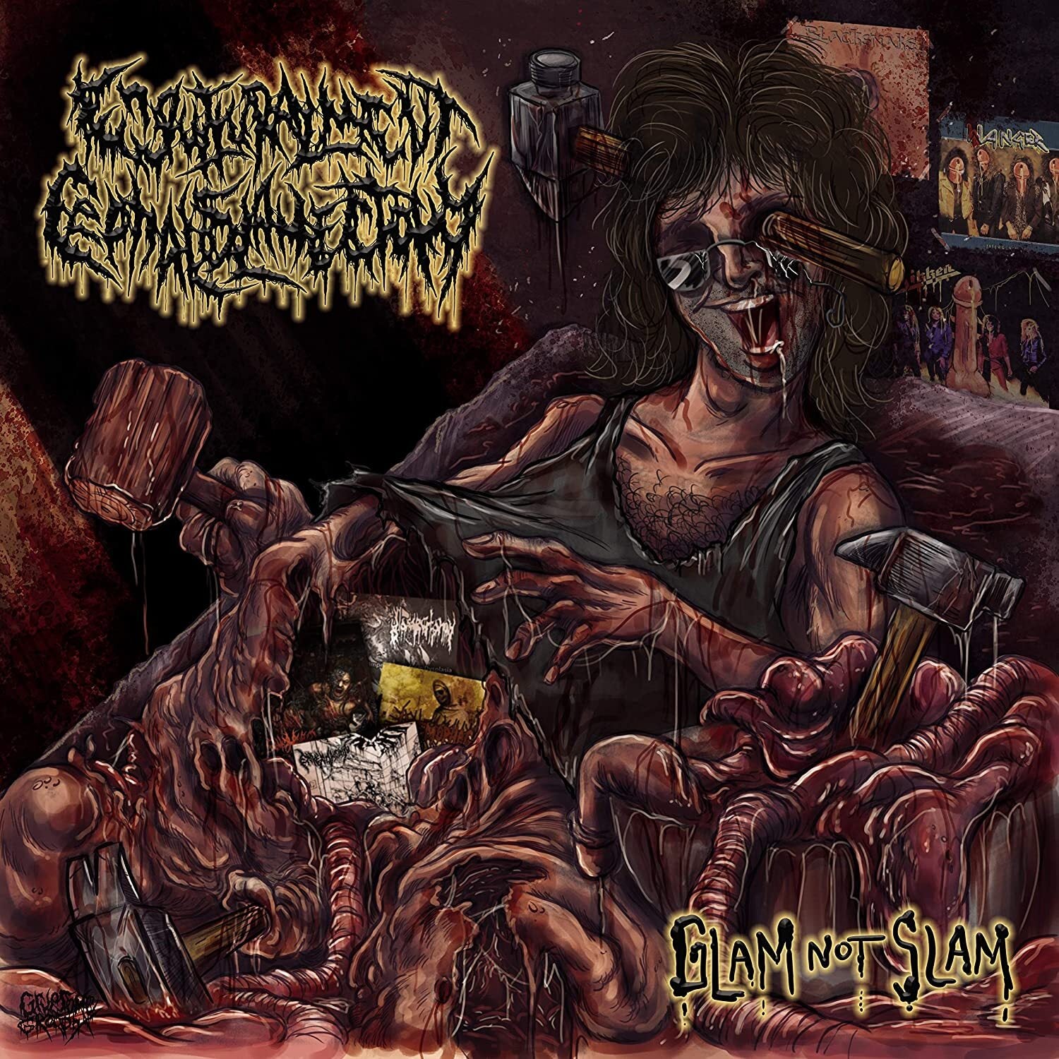 Ephaloslamectomy