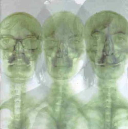 Supergrass