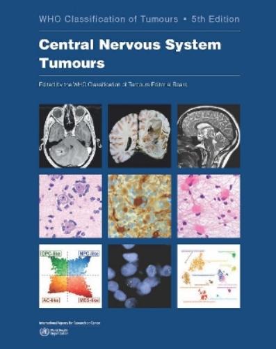 WHO classification of tumours of the central nervous system