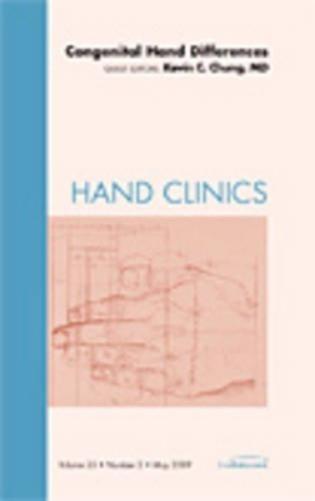 Congenital Hand Differences, An Issue of Hand Clinics
