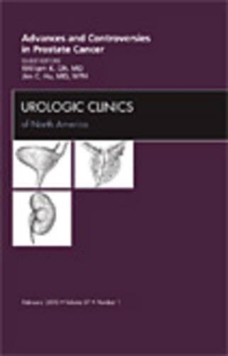 Advances and Controversies in Prostate Cancer, An Issue of Urologic Clinics