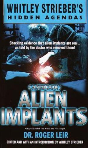 Alien Implants
