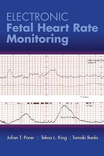 Electronic Fetal Heart Rate Monitoring