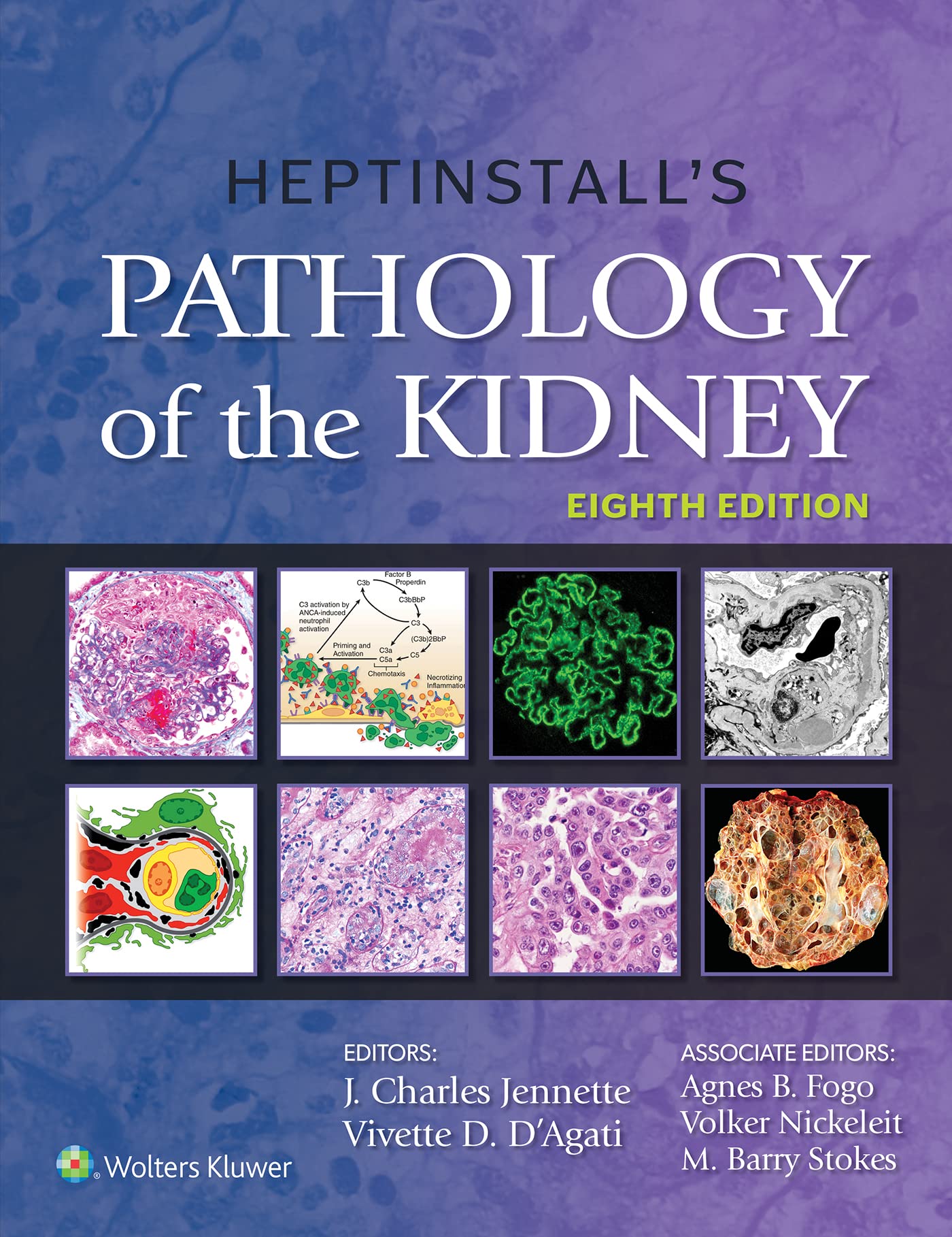Heptinstall Pathology Of Kidney 8E Cb