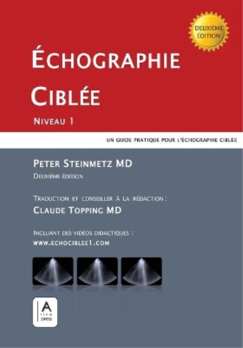 Échographie Ciblée