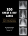 200 Chest X-Ray Cases