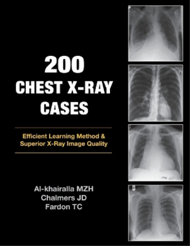 200 Chest X-Ray Cases