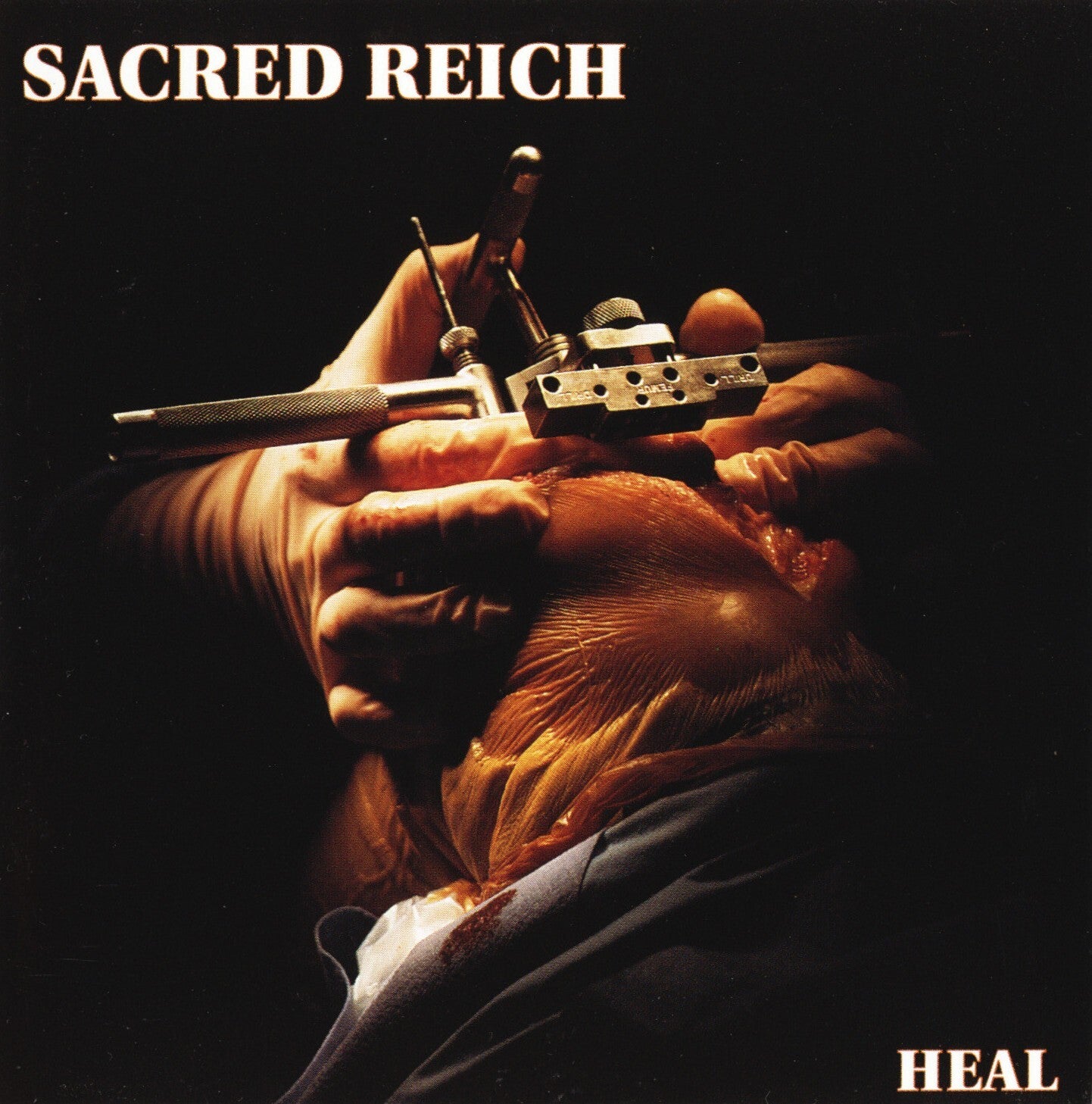 Heal