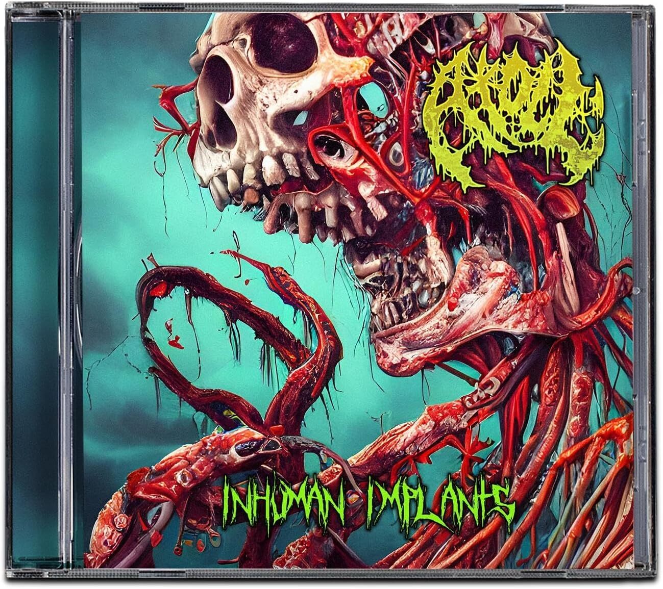 Inhuman Implants