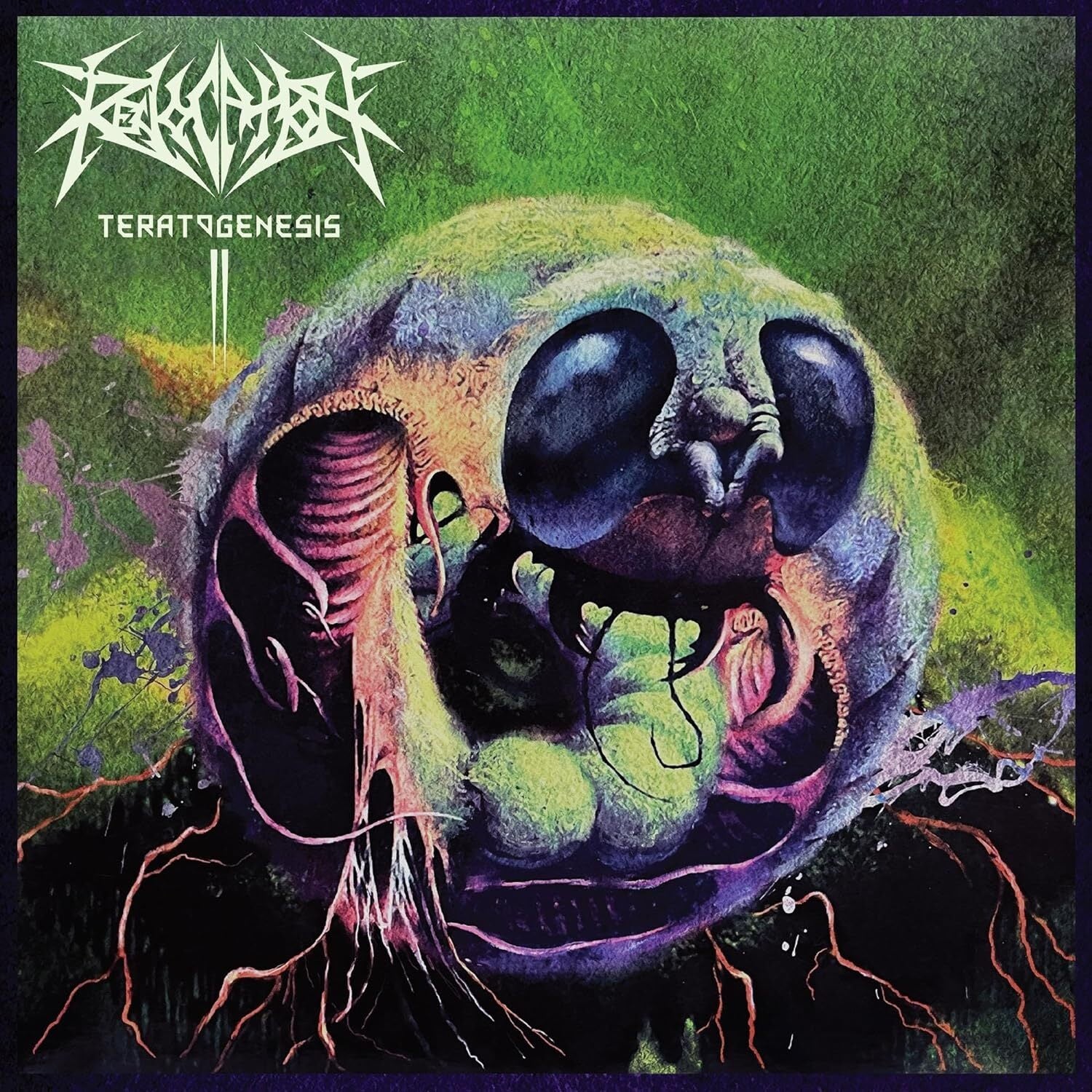 Teratogenesis