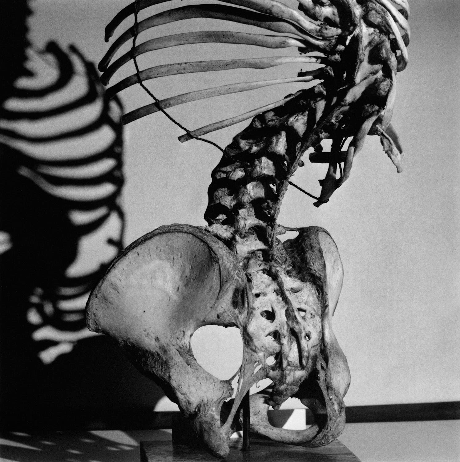 Diana Michener: Bones