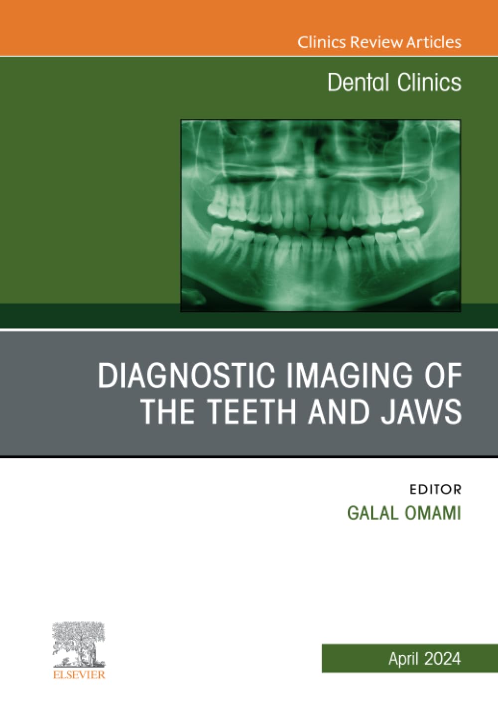 Diagnostic Imaging of the Teeth and Jaws, An Issue of Dental Clinics of North America