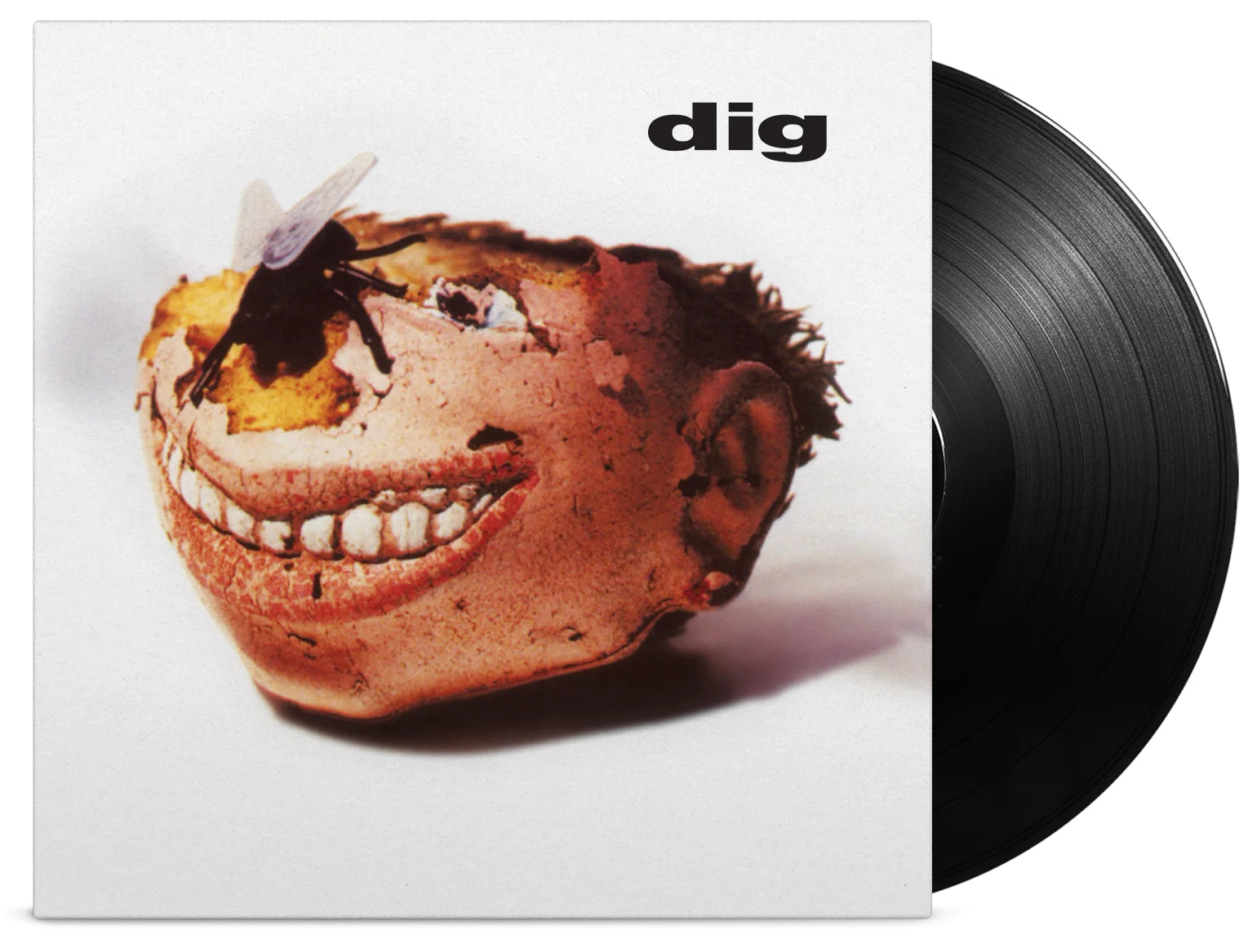 Dig