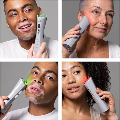 Magnitone FaceRocket Facial 5in1 Device