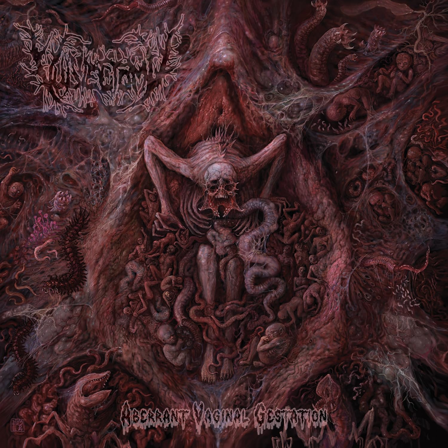 Aberrant Vaginal Gestation