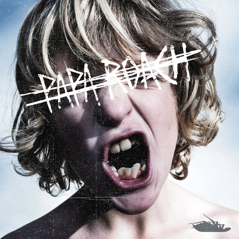 Crooked Teeth