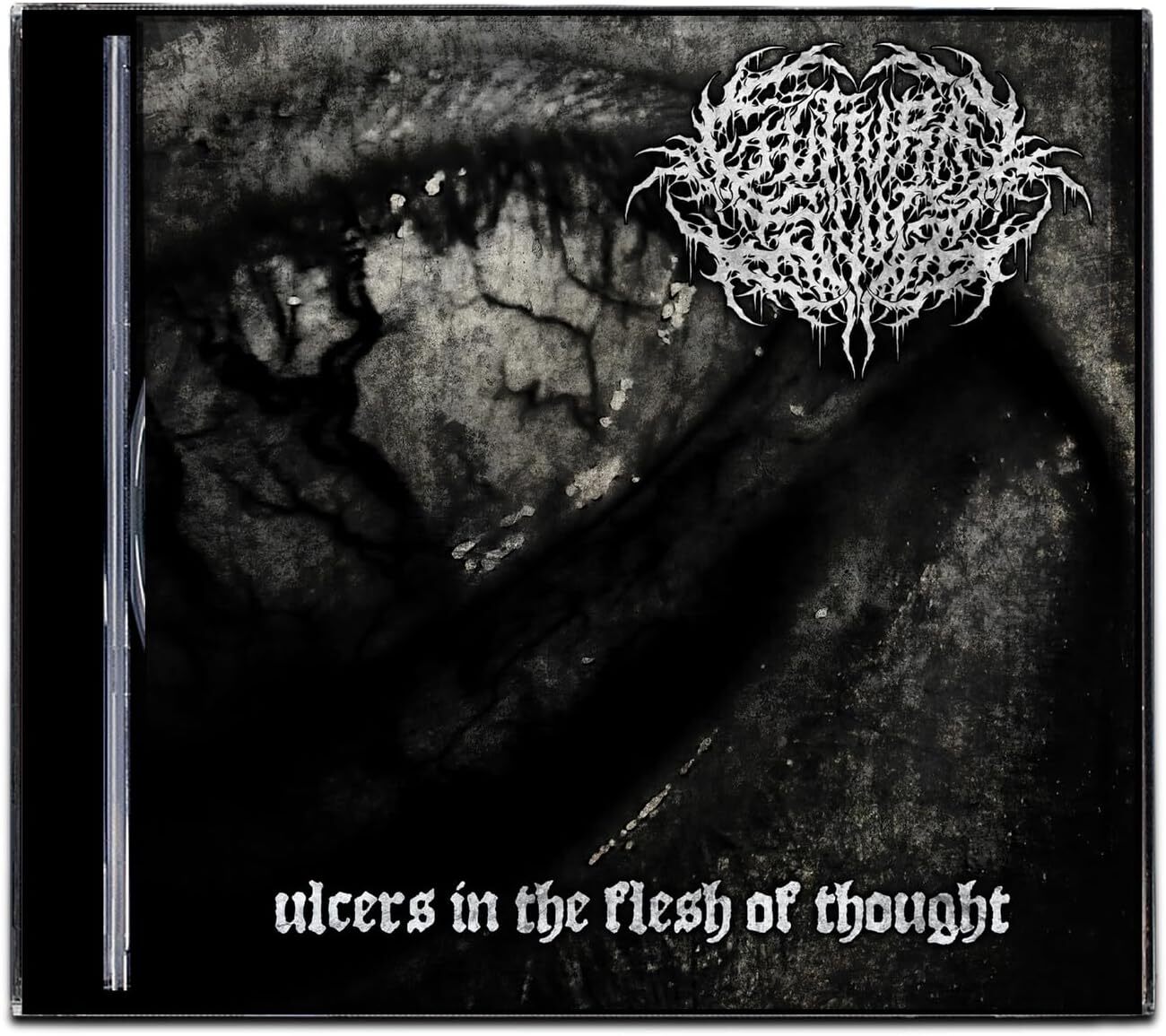 Ulcers in the Flesh of Thought