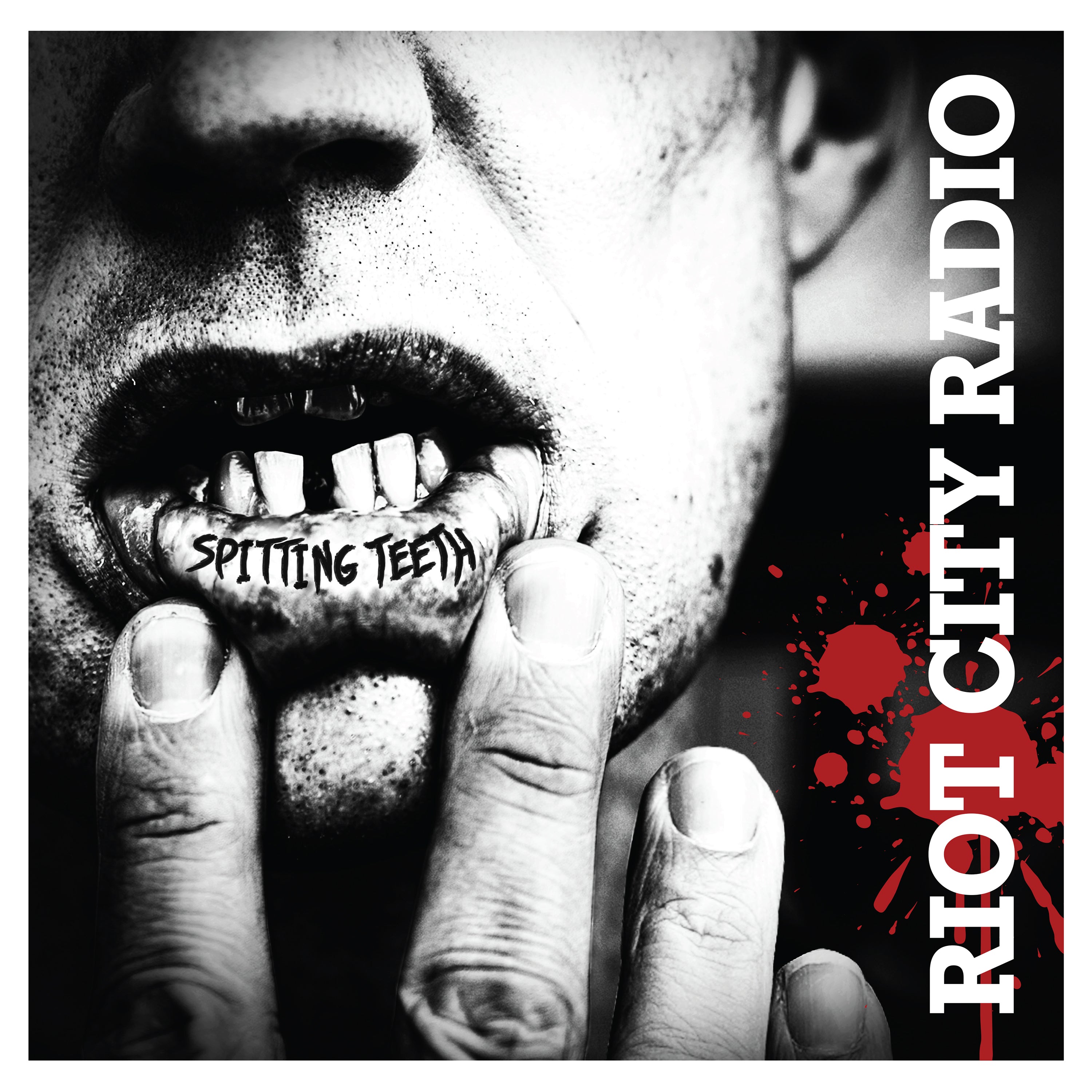 Spitting Teeth