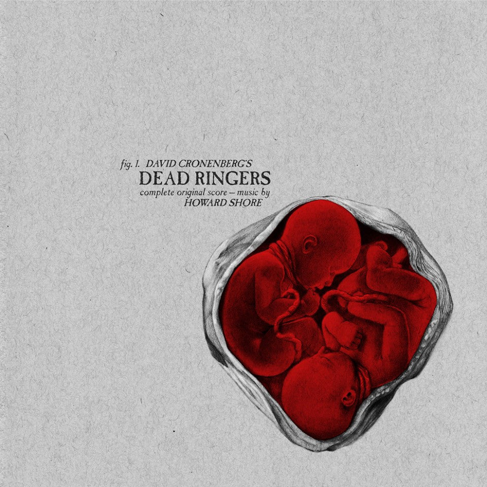 Dead Ringers