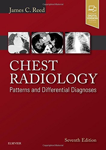 Chest Radiology