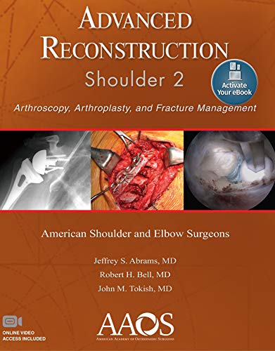Advanced Reconstruction Of Shoulder