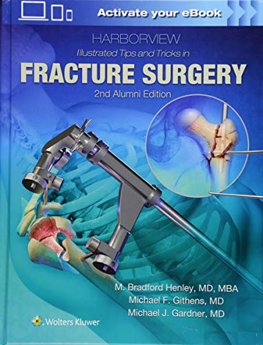 Harborview Illustrated Tips And Tricks In Fracture Surgery