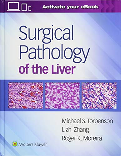 Surgical Pathology Of The Liver