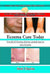 Eczema Cure Today - Get rid of Eczema forever natural ways to cure Eczema