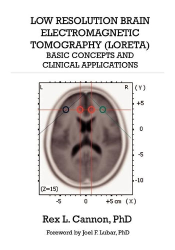 Low Resolution Brain Electromagnetic Tomography (LORETA)