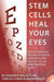 Stem Cells Heal Your Eyes