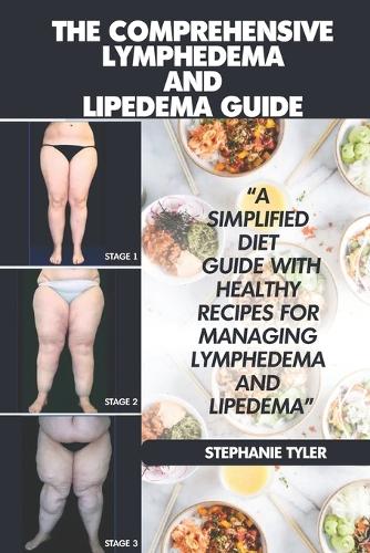 The Comprehensive Lymphedema and Lipedema Guide