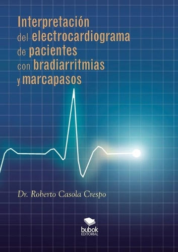 Interpretación del electrocardiograma de pacientes con bradiarritmias y marcapasos