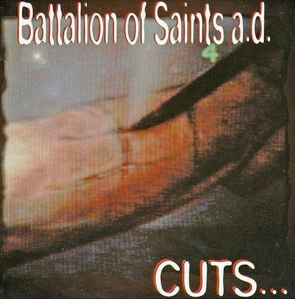 Cuts