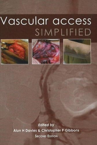 Vascular Access Simplified; second edition