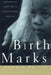 Birthmarks