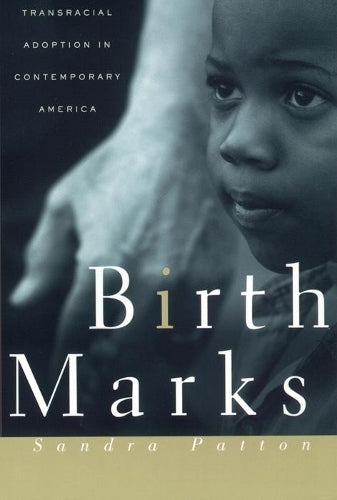 Birthmarks